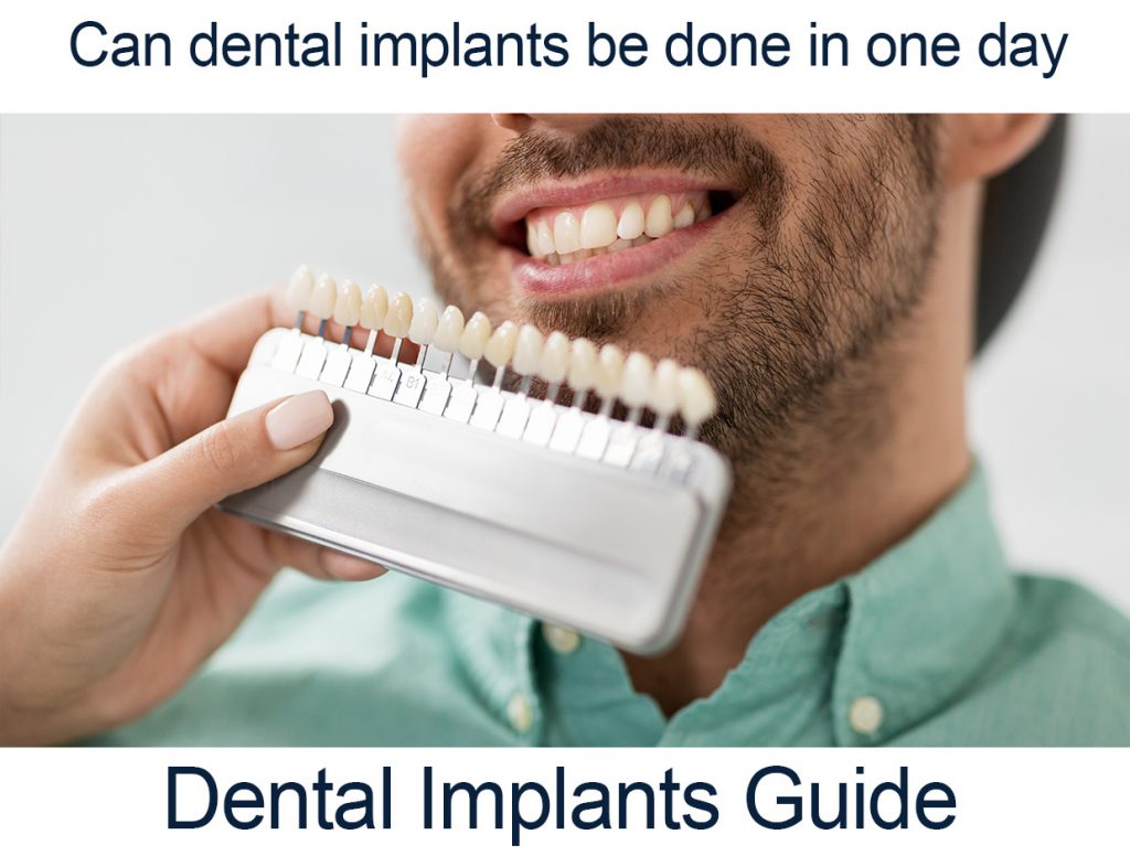 Dental implants Brisbane