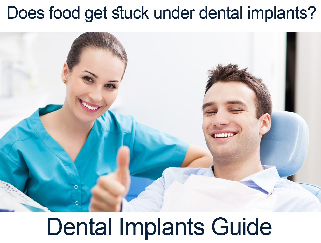 dental implant perth