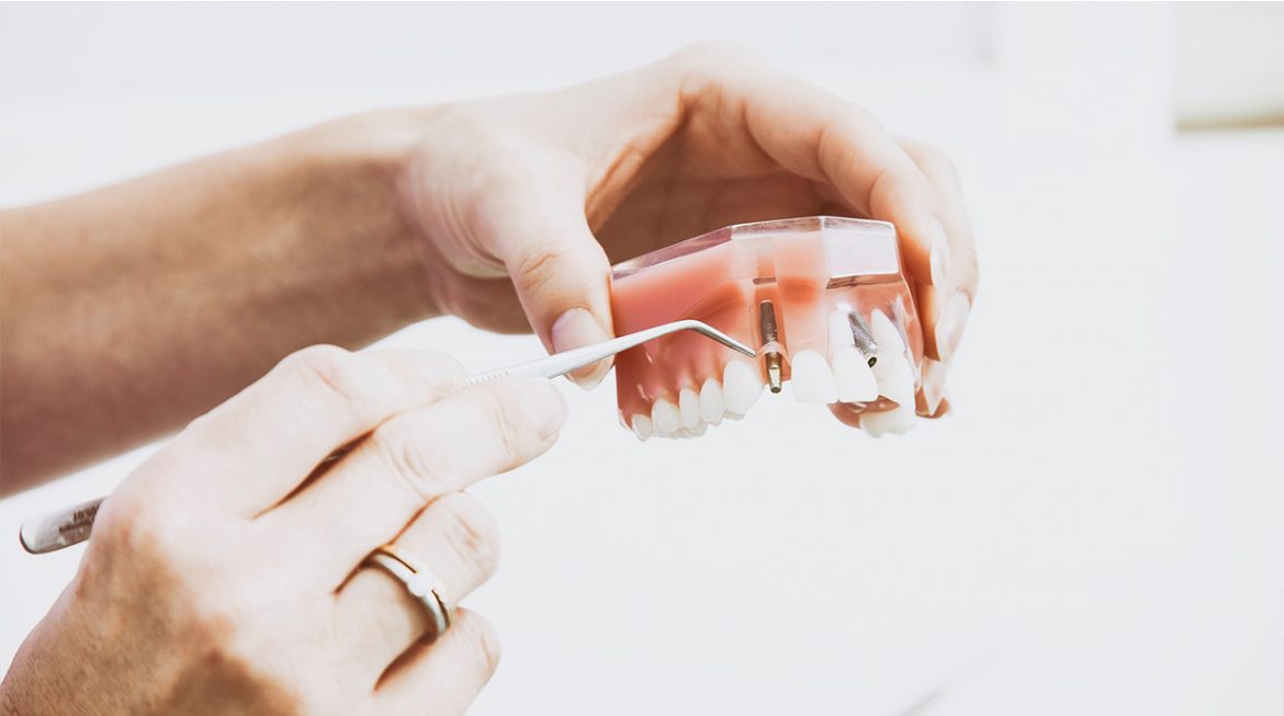 Dental guide for implants