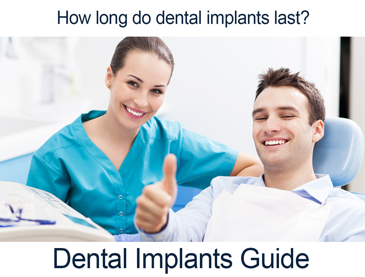 Dental Implants in perth
