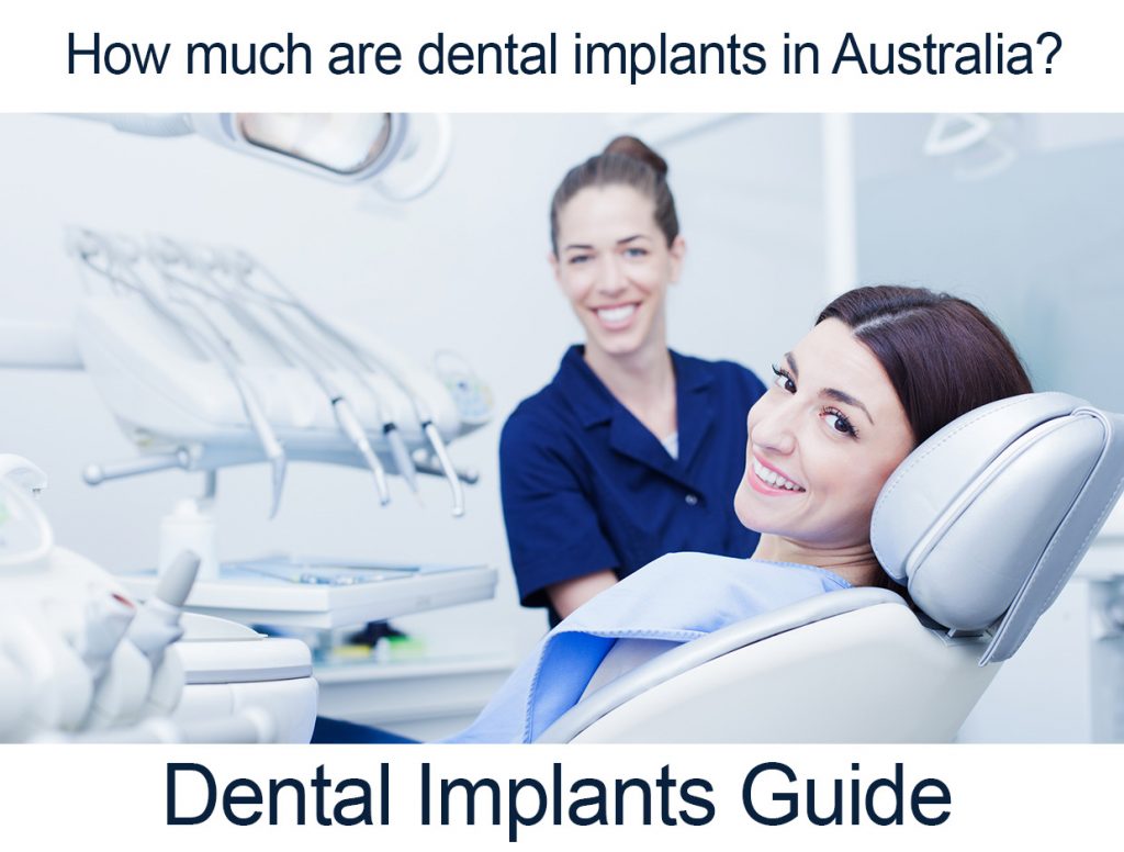 Best dental implants in Perth