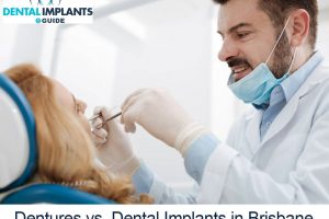 Dentures vs. Dental Implants in Brisbane