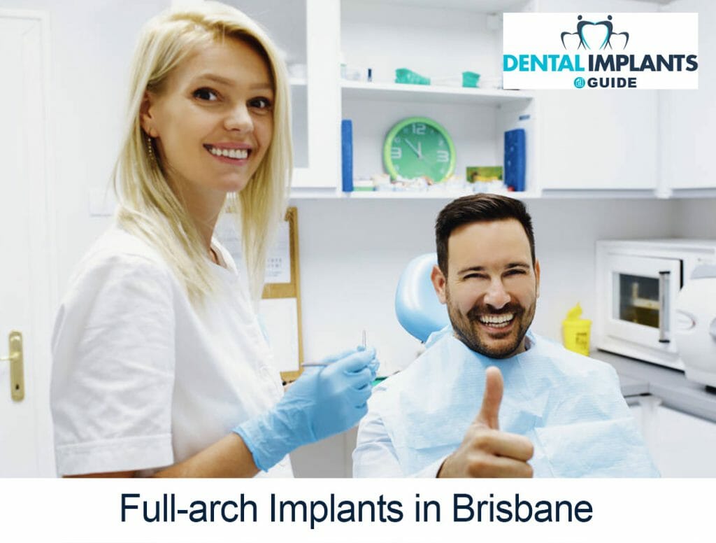Full-arch Implants in Brisbane