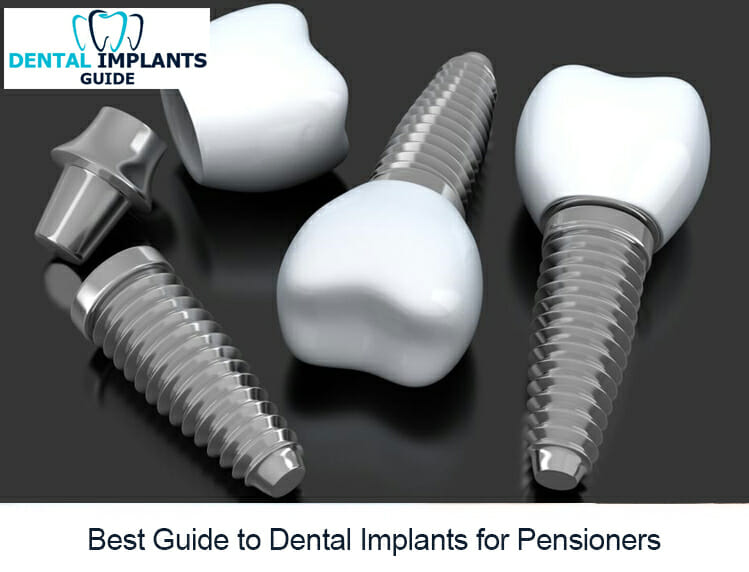 Best Guide to Dental Implants for Pensioners 