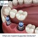 What are Implant-Supported Dentures? 