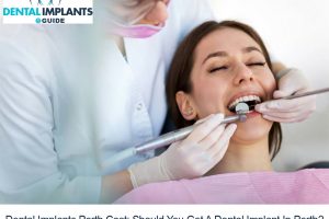 Dental Implants Perth Cost: Should You Get A Dental Implant In Perth?