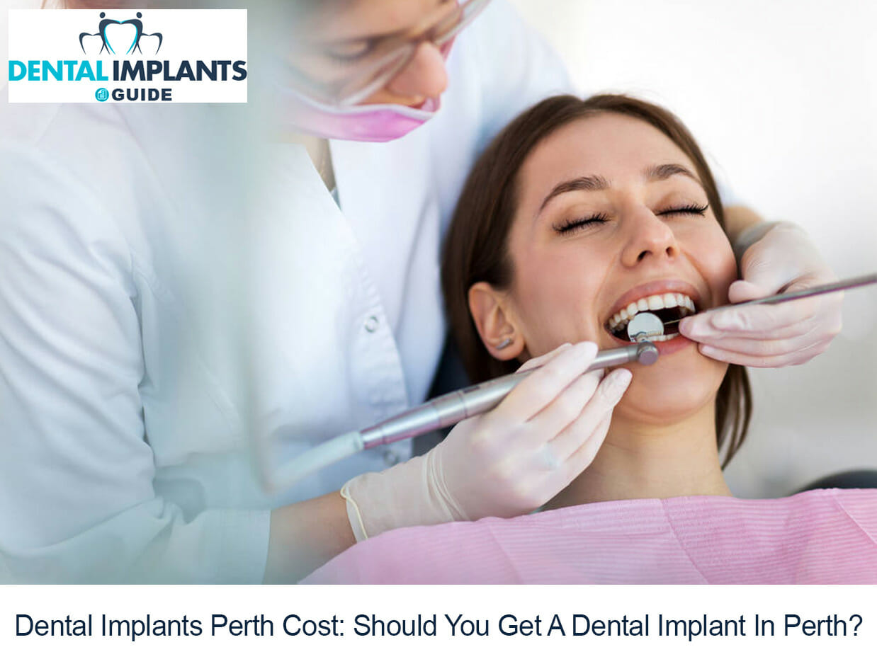 Dental Implants Perth Cost- Should You Get A Dental Implant In Perth