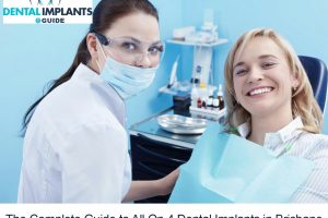 The Complete Guide to All On 4 Dental Implants in Brisbane